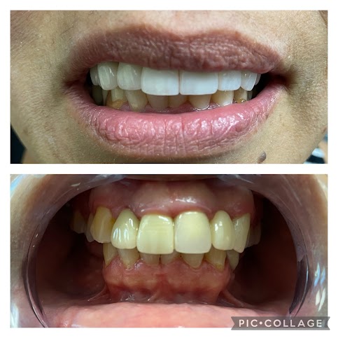 Before - After/ Additional Services - Healing Dentistry