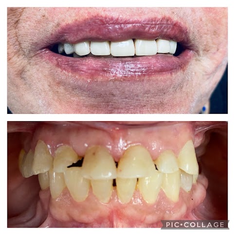Before - After/ Additional Services - Healing Dentistry