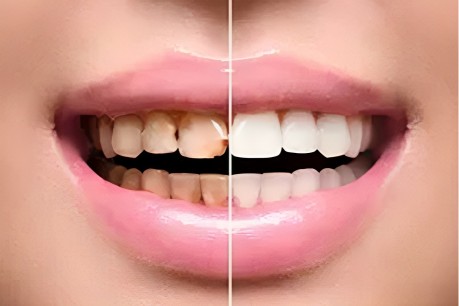 Cosmetic Dentistry - Healing Dentistry