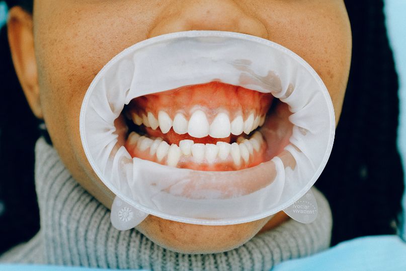 Oral Health - Healing Dentistry
